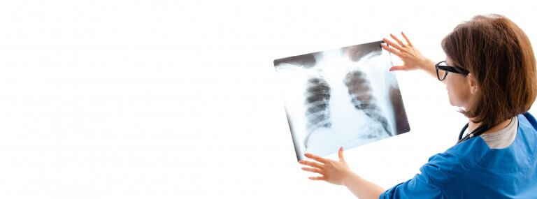 Chest X-ray | PHA