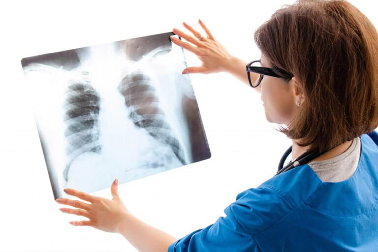 Chest X-Ray